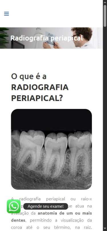 Página periapical no celular com título, radiografia e início do texto em uma coluna, com WhatsApp sobreposto.