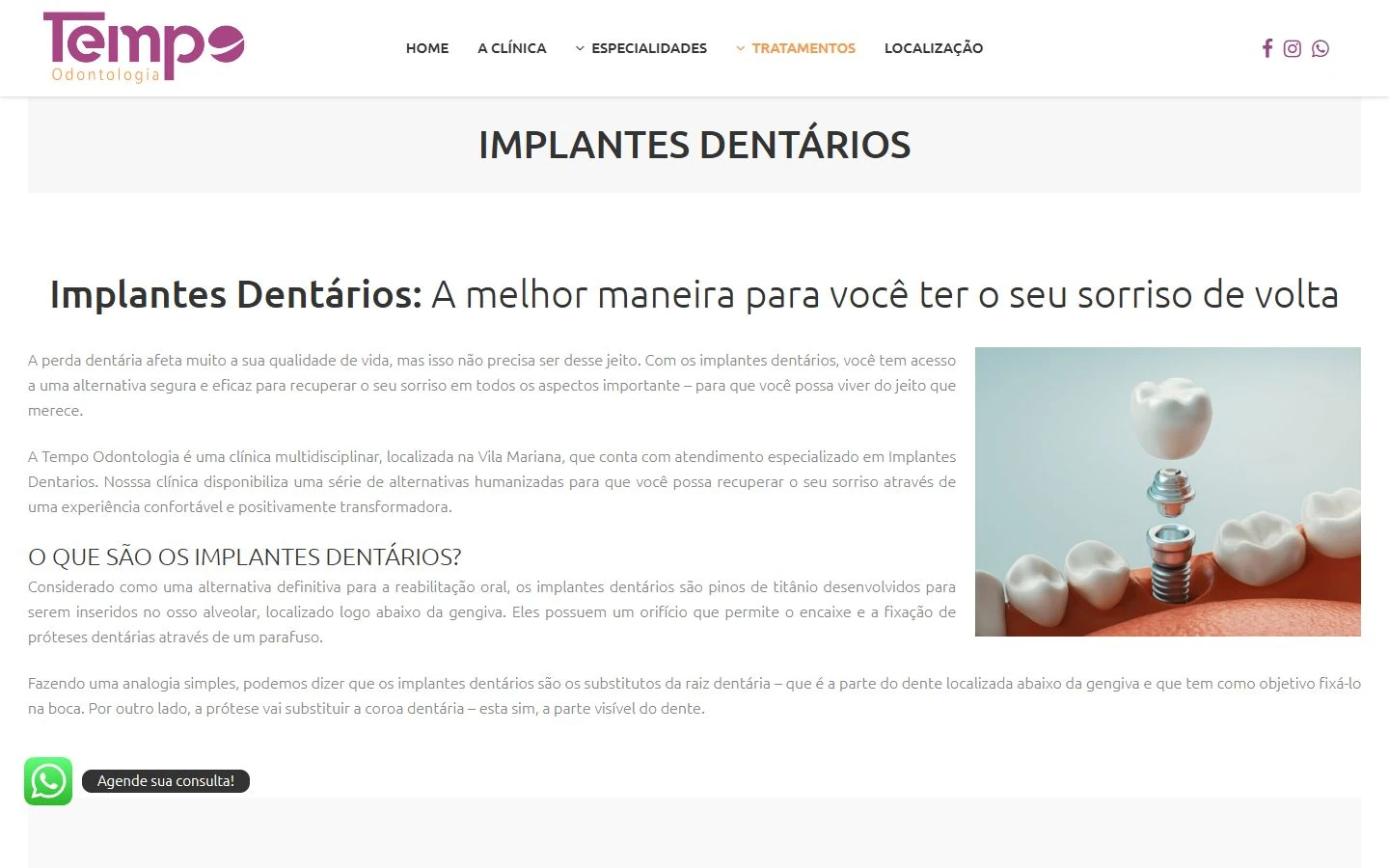 Abertura da página de implantes, com faixa de título, texto à esquerda, imagem de implante à direita e botão flutuante.